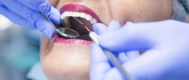 Best Knocked-Out Tooth (Avulsed Tooth) Treatment in North Seekonk, MA